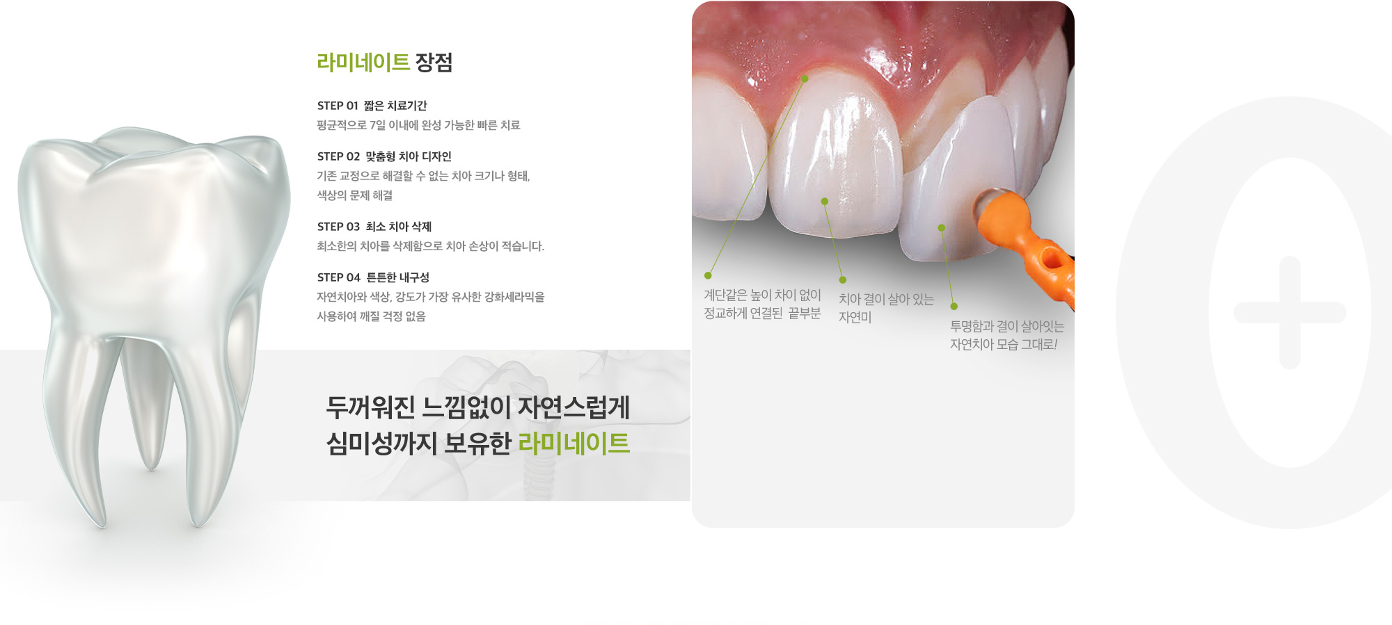 최소삭제 라미네이트