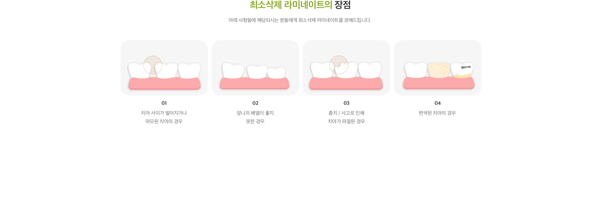 최소삭제 라미네이트