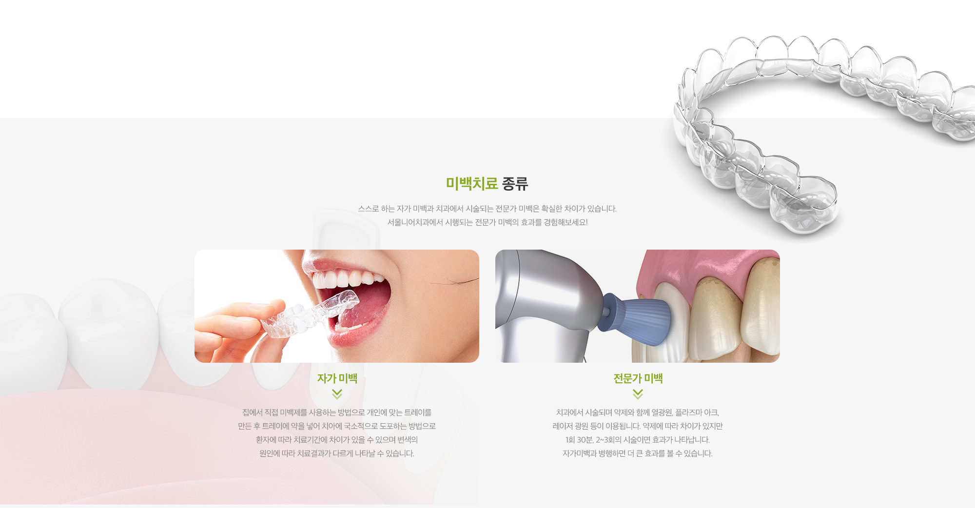 미백치료
