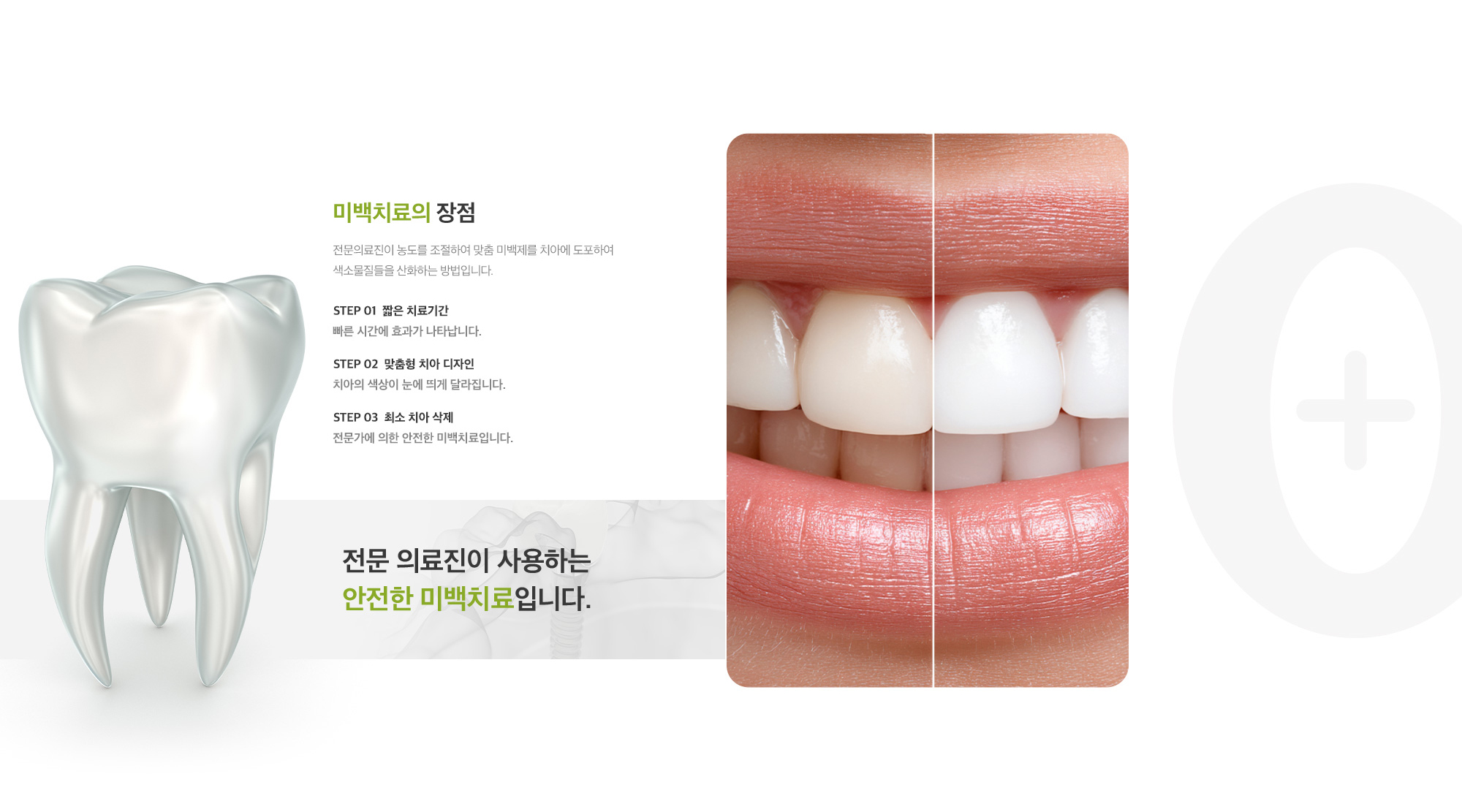 미백치료