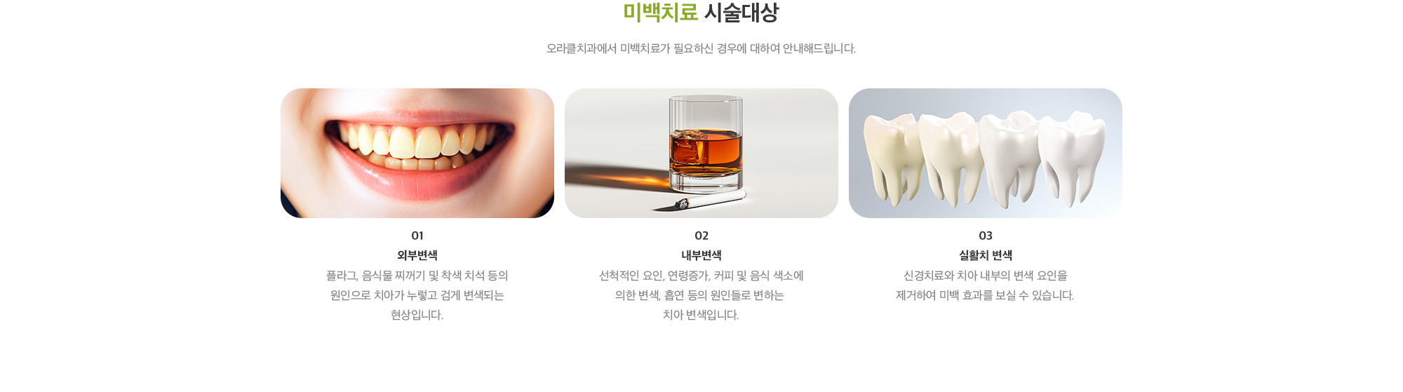 미백치료