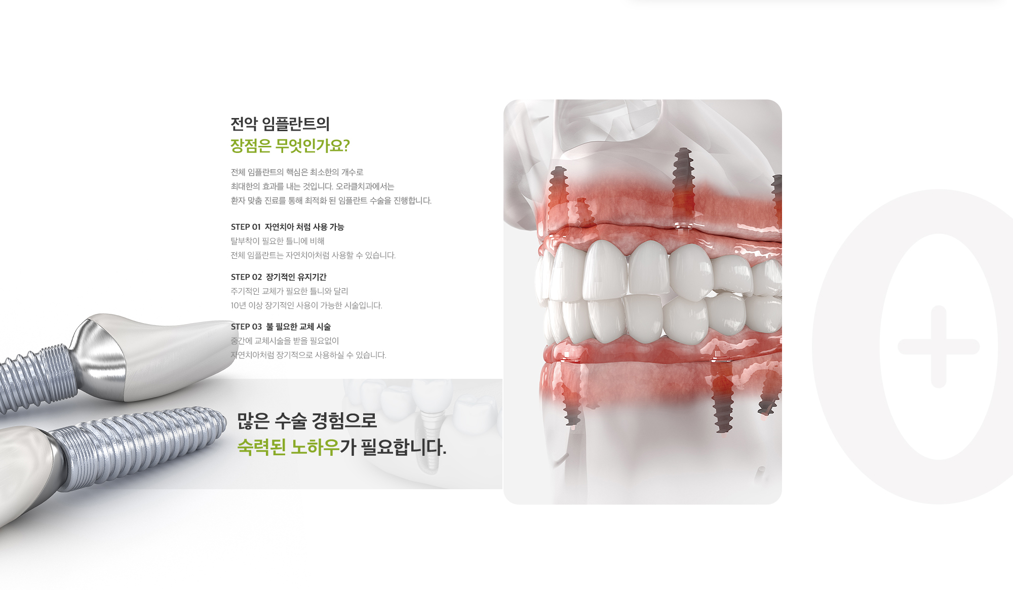 전악 임플란트의 장점 : 자연치아 처럼 사용 가능, 장기적인 유지기간, 불 필요한 교체 시술