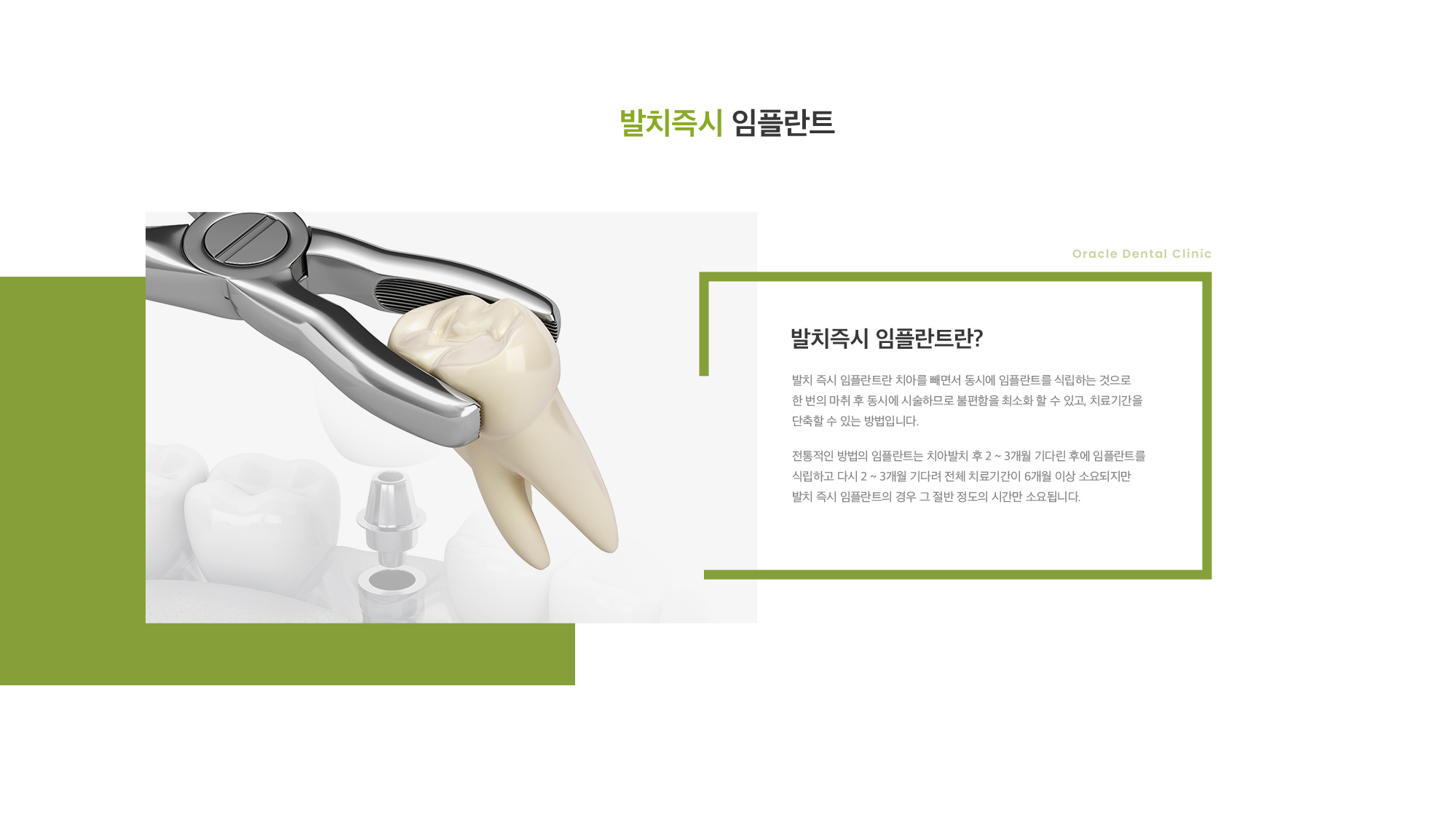 발치즉시 임플란트란? 발치 즉시 임플란트란 치아를 빼면서 동시에 임플란트를 식립하는 것으로 한 번의 마취 후 동시에 시술하므로 불편함을 최소화 할 수 있고, 치료기간을 단축할 수 있는 방법입니다. 전통적인 방법의 임플란트는 치아발치 후 2 ~ 3개월 기다린 후에 임플란트를 식립하고 다시 2 ~ 3개월 기다려 전체 치료기간이 6개월 이상 소요되지만 발치 즉시 임플란트의 경우 그 절반 정도의 시간만 소요됩니다.