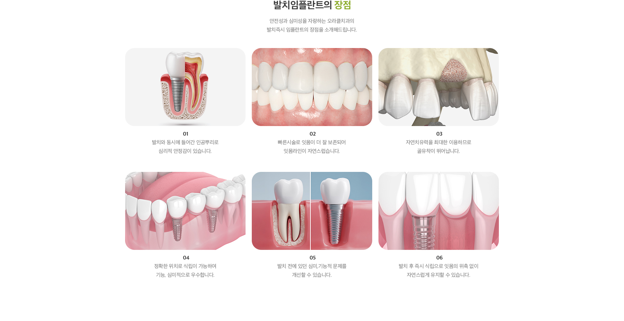 발치임플란트의 장점 : 1. 발치와 동시에 들어간 인공뿌리로 심리적 안정감이 있습니다, 2. 빠른시술로 잇몸이 더 잘 보존되어 잇몸라인이 자연스럽습니다, 3. 자연치유력을 최대한 이용하므로 골유착이 뛰어납니다, 4. 정확한 위치로 식립이 가능하여 기능, 심미적으로 우수합니다, 5. 발치 전에 있던 심미,기능적 문제를 개선할 수 있습니다, 6. 발치 후 즉시 식립으로 잇몸의 위축 없이 자연스럽게 유지할 수 있습니다.