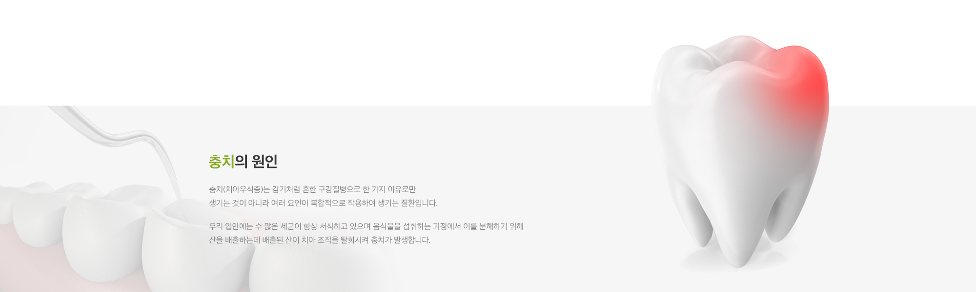 충치 클리닉