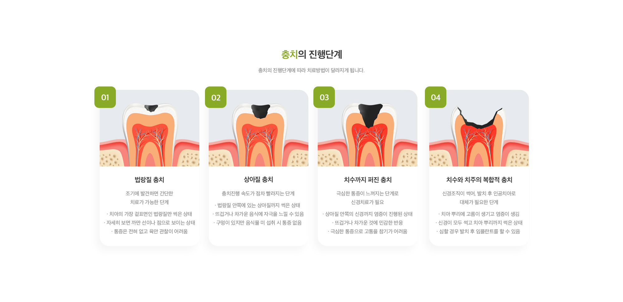 충치 클리닉