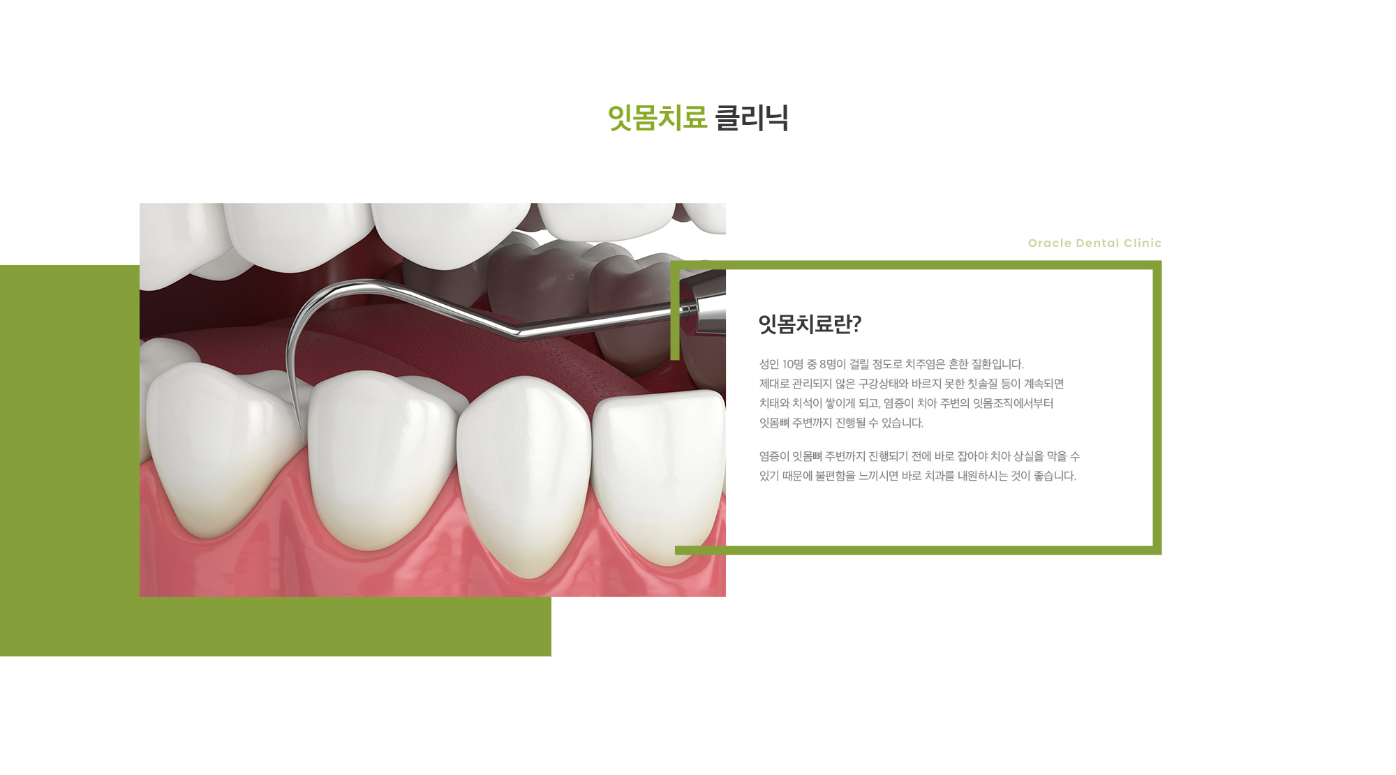 잇몸 치료