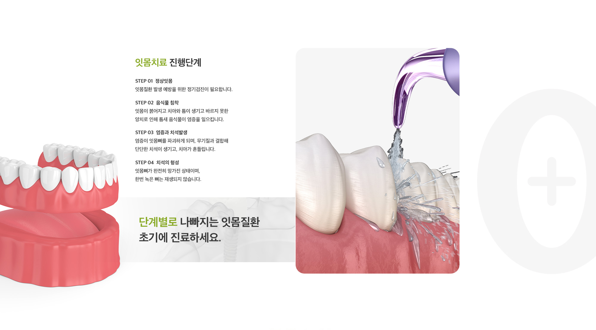 잇몸 치료