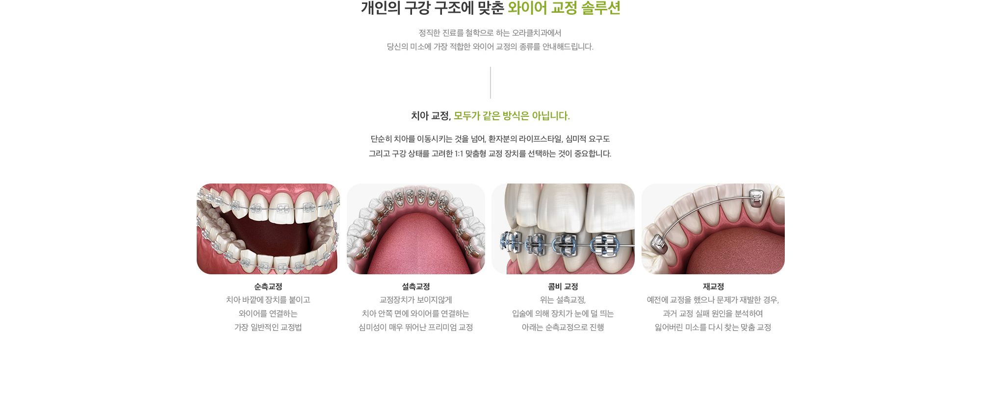 개인의 구강 구조에 맞춘 와이어 교정 솔루션 정직한 진료를 철학으로 하는 오라클치과에서 당신의 미소에 가장 적합한 와이어 교정의 종류를 안내해드립니다. 단순히 치아를 이동시키는 것을 넘어, 환자분의 라이프스타일, 심미적 요구도 그리고 구강 상태를 고려한 1:1 맞춤형 교정 장치를 선택하는 것이 중요합니다.